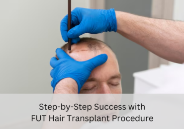 FUT hair transplant procedure