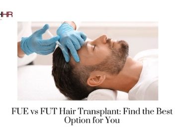 FUE vs FUT Hair Transplant