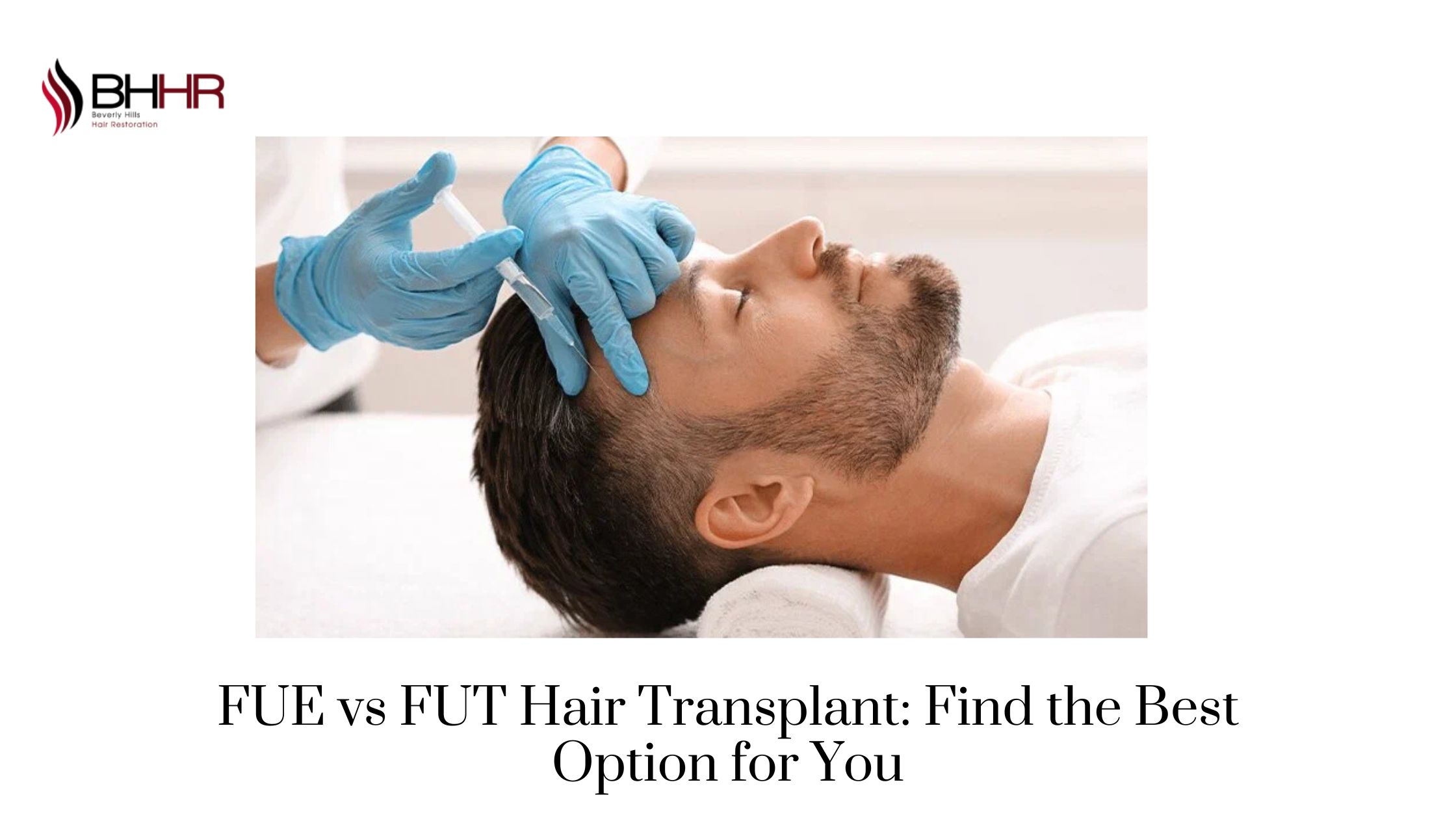FUE vs FUT Hair Transplant