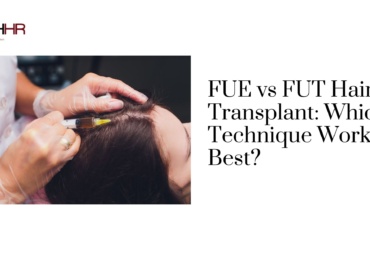 FUE vs FUT Hair Transplant