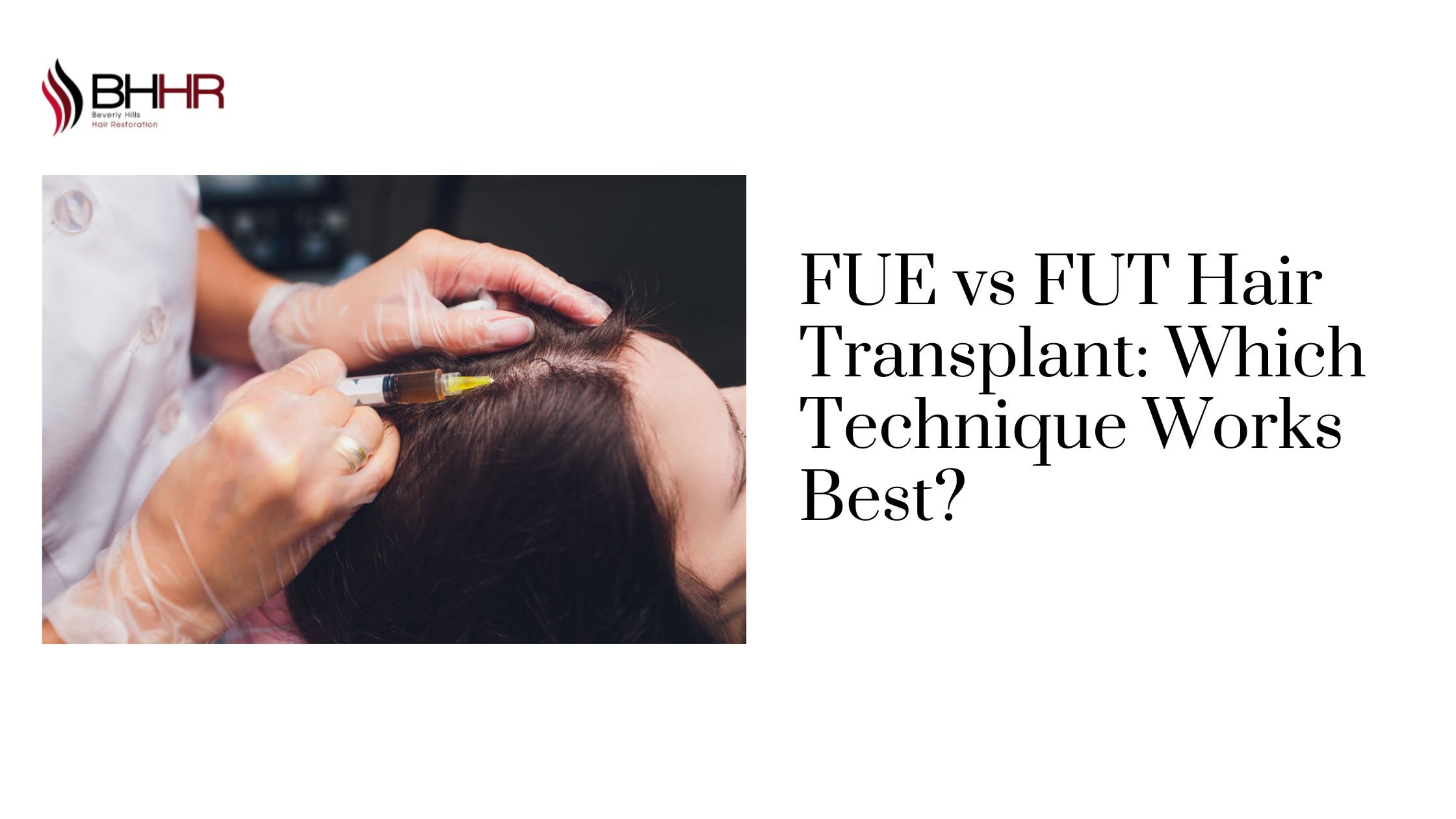 FUE vs FUT Hair Transplant